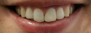 533-DSC_1247-thumb-400x148-532