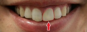 535-DSC_1247-thumb-400x148-534