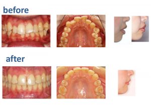 汐留シティセンター歯科 矯正治療