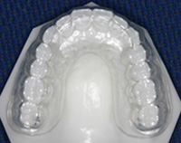 汐留シティセンター歯科 矯正歯科 クリアリテーナー矯正