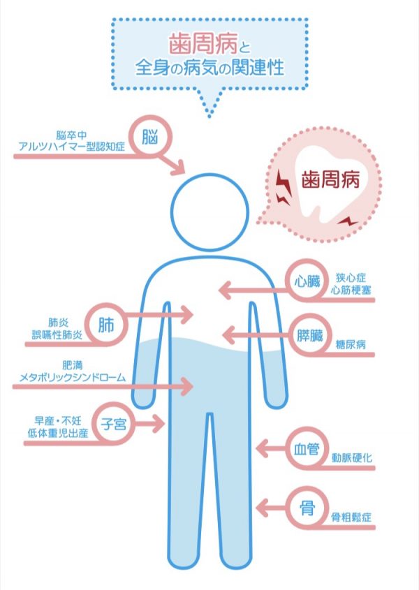 汐留シティセンター歯科 歯周病治療 全身の病気との関係